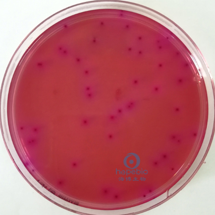 弗氏柠檬酸杆菌  紫红色菌落，可有胆盐沉淀环