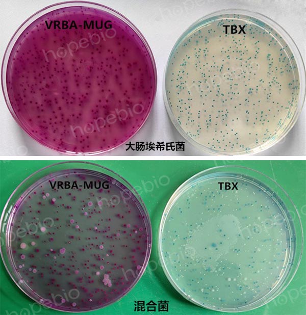 图4-1  大肠埃希氏菌的生长特征和混合菌分离效果