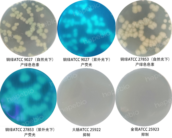 图1假单胞CFC选择性培养基的微生物九鼎彩票平台结果