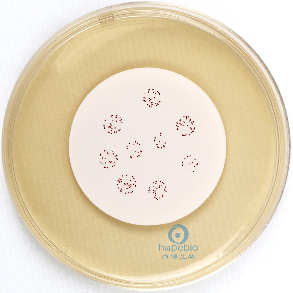 图1 粪肠球菌在滤膜肠球菌琼脂上的生长特征