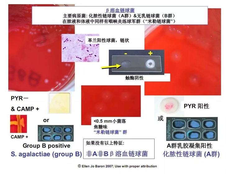 β溶血链球菌的各项生化特征