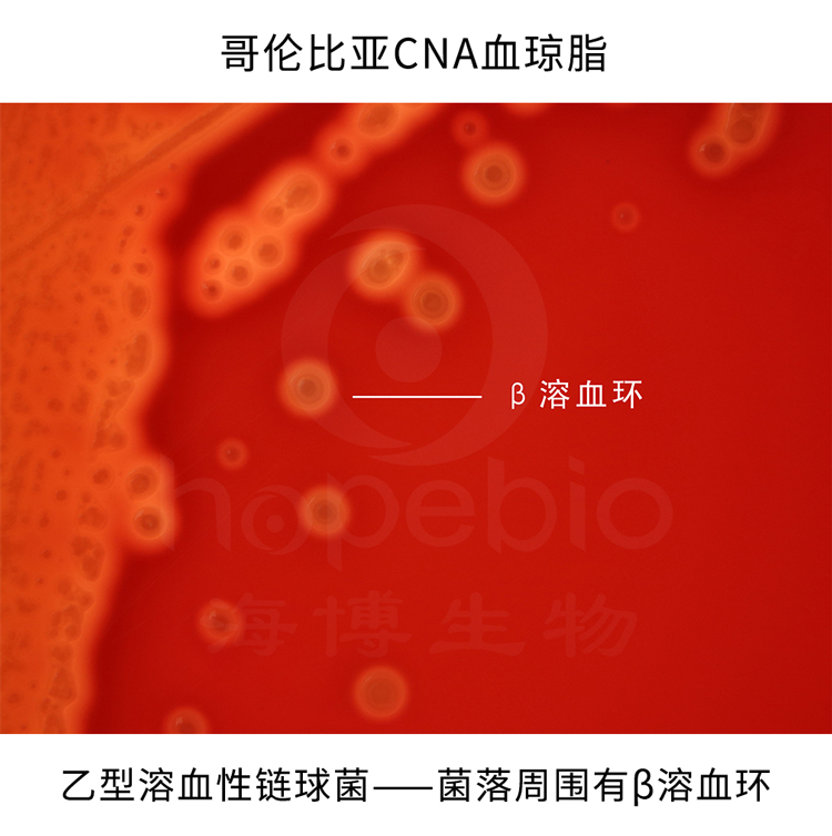 哥伦比亚CNA血琼脂—乙型溶血性链球菌
