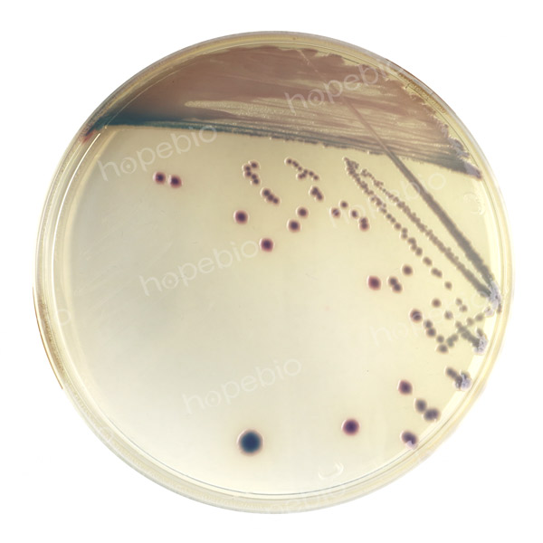尿道定位显色培养基——弗氏柠檬酸盐杆菌