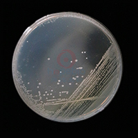 大肠埃希氏菌-DNA酶琼脂