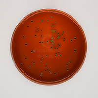 大肠埃希氏菌在伊红美蓝琼脂（EMB）上的生长特征/