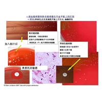 α溶血链球菌和肺炎链球菌在羊血平板上的区别/