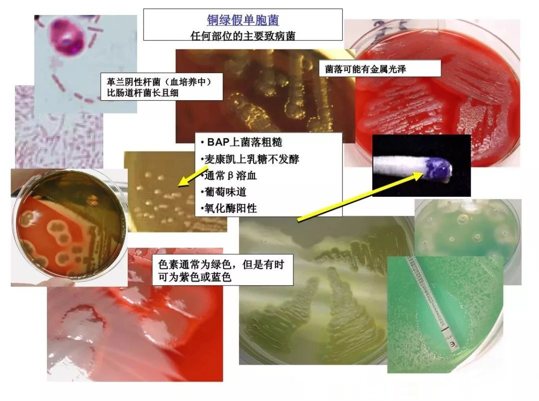 铜绿假单胞菌生化特征/