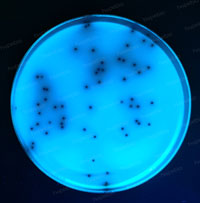 粪肠球菌——胆盐七叶苷琼脂