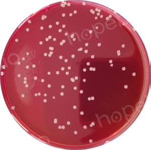 三株伯克霍尔德菌在含多粘菌素B、庆大霉素的BCSA琼脂平板上的菌落特征/