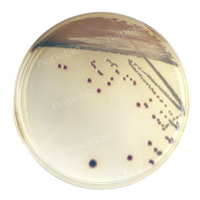 尿道定位显色培养基——弗氏柠檬酸盐杆菌