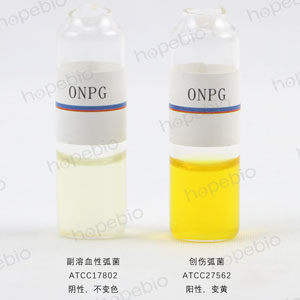 ONPG-副溶血性弧菌、创伤弧菌