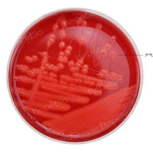 血平板-产气荚膜梭菌
