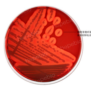 胰酪胨大豆羊血（TSSB）琼脂——蜡样芽孢杆菌
